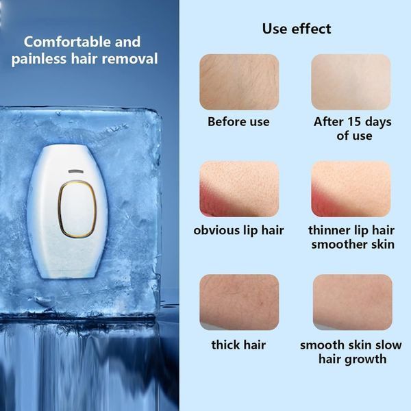 Портативний жіночий домашній фотоепілятор для тіла IPL Hair Removal Device для всіх типів волосся ∙ Жіночий лазерний епілятор для всього тіла IPL Hair Removal 56904 фото
